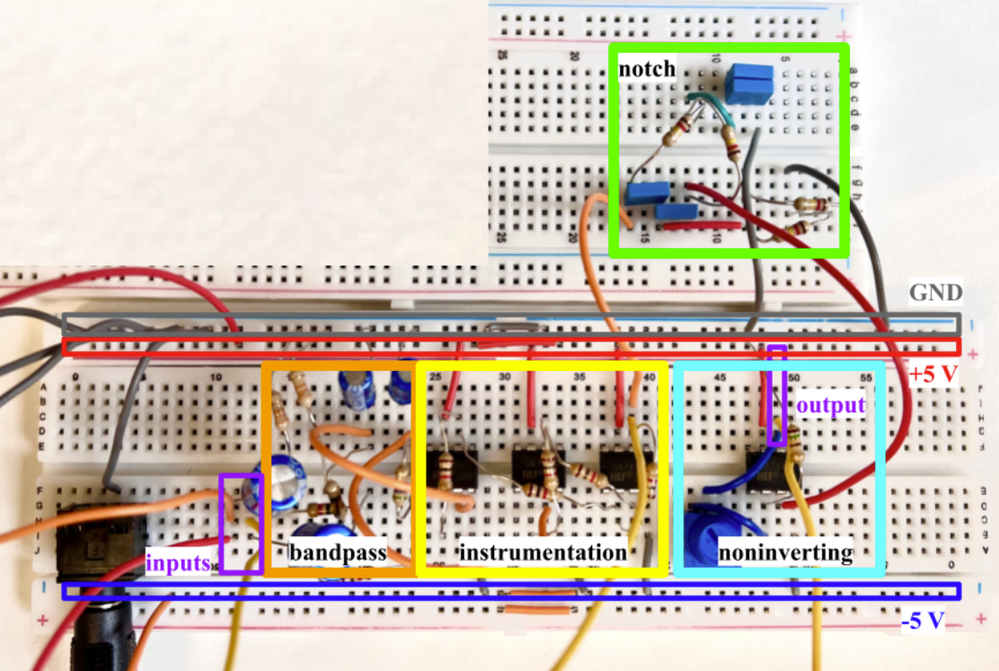 Breadboard setup of the ECG circuit prototype